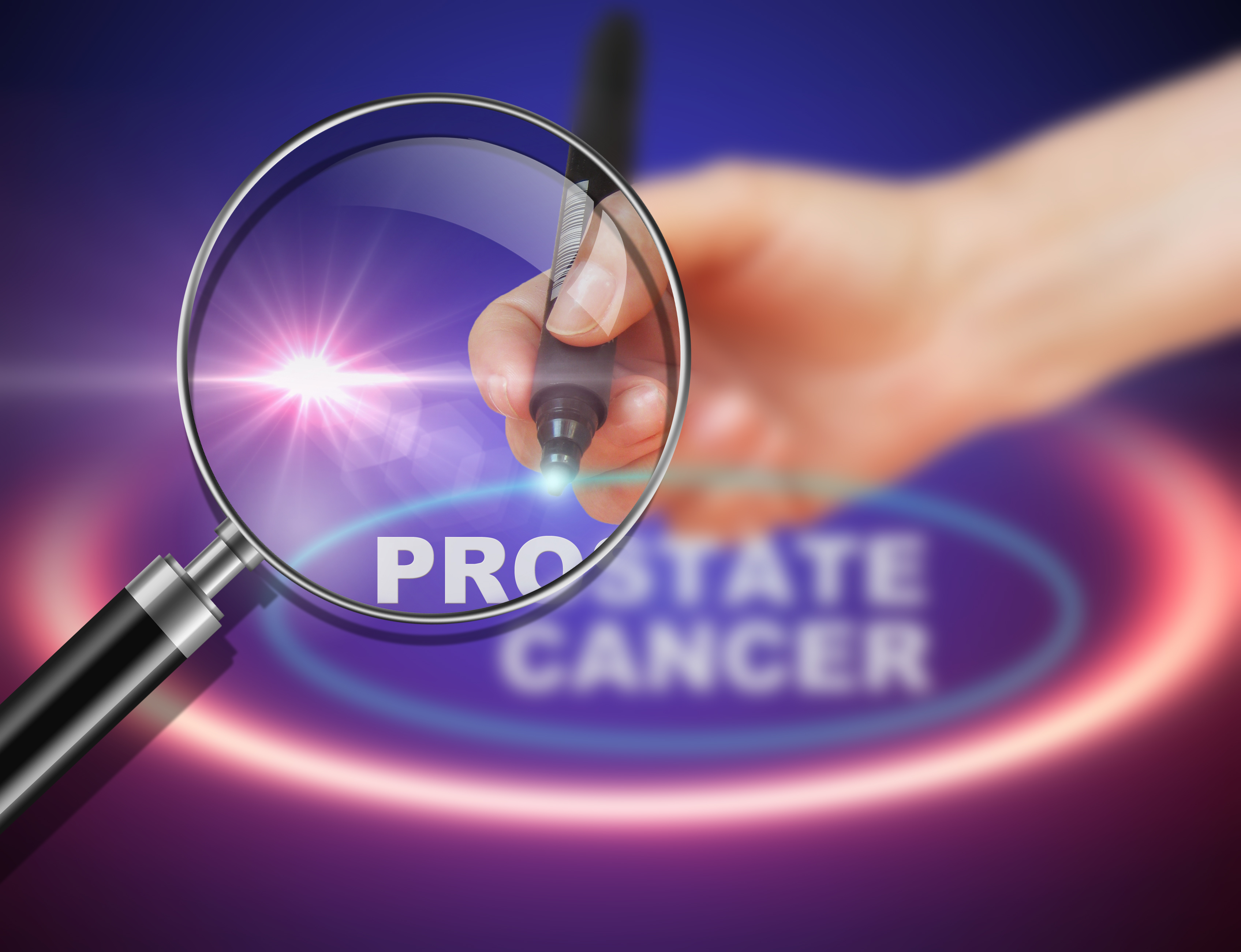 writing word  PROSTATE CANCER with marker on gradient background made in 2d software