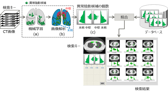 これからのct画像はaiで診断支援 類似症例の正解率は85 診断時間は6分の1 Fujitsu Journal 富士通ジャーナル