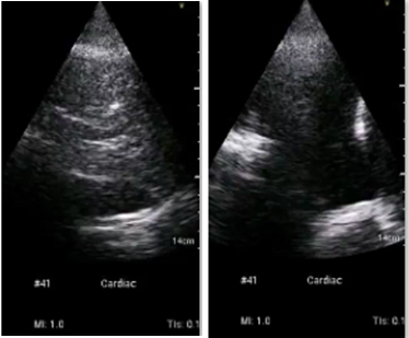 Ultrasound.jpg