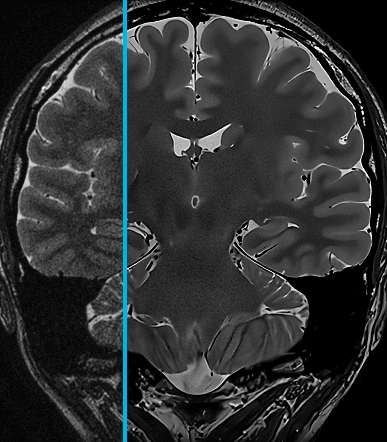 brain scan.jpg