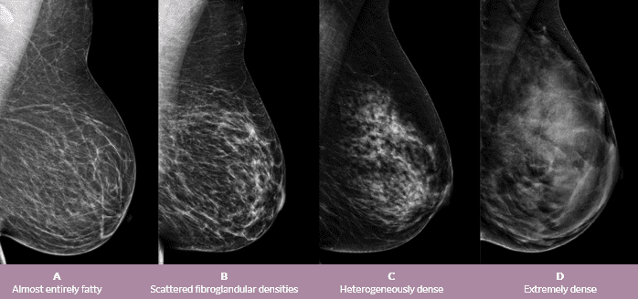 Don T Leave It To Chance This Risk Assessment Could Change Your Breast Care Ge Healthcare United States