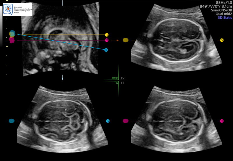 Pregnancy times how many in ultrasound This Is