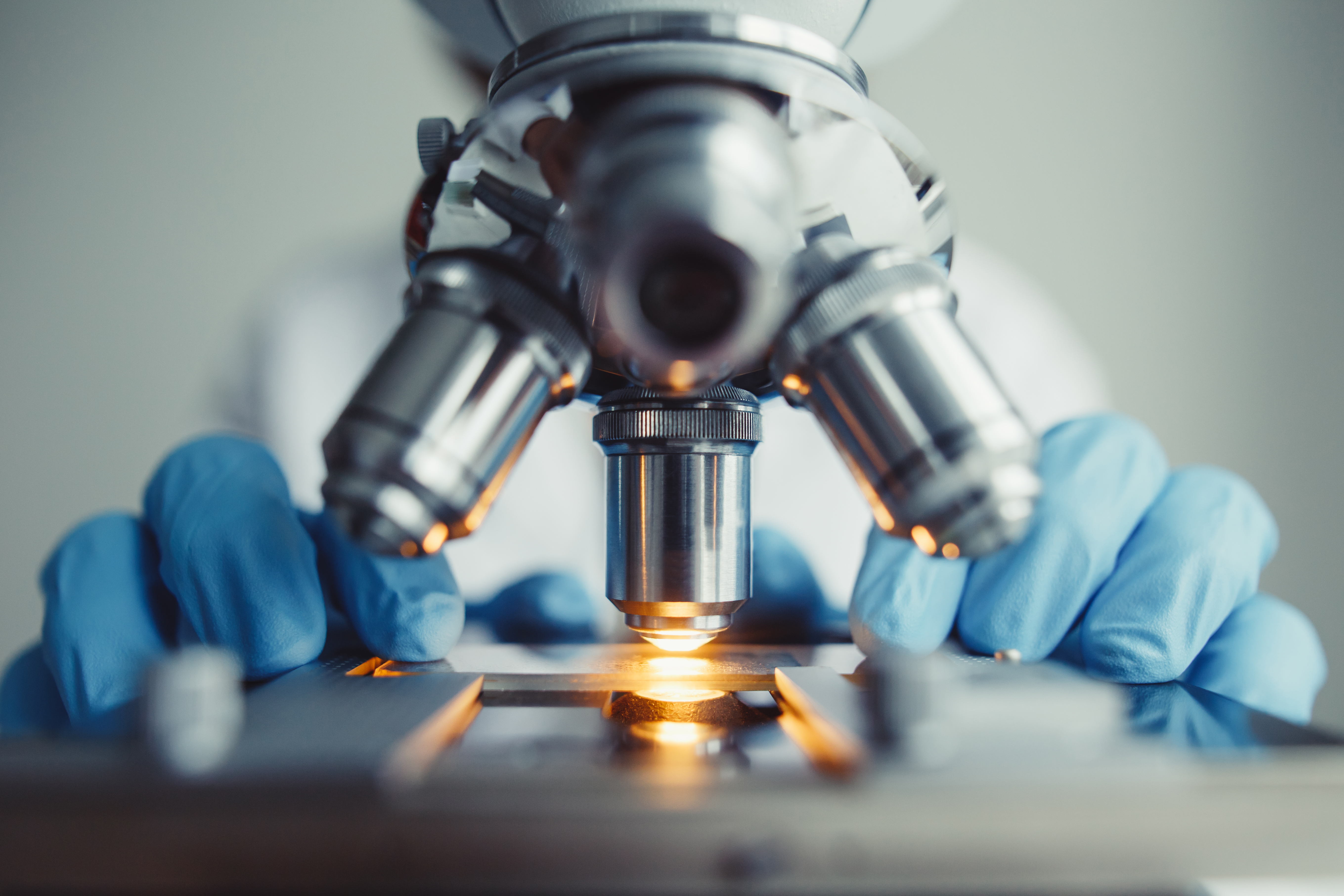 Fishing for new leads in a rare melanoma | GE HealthCare (United States)